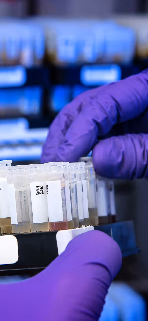 Ľudské telo ako raj pre mikróby - pre tie dobré i zlé