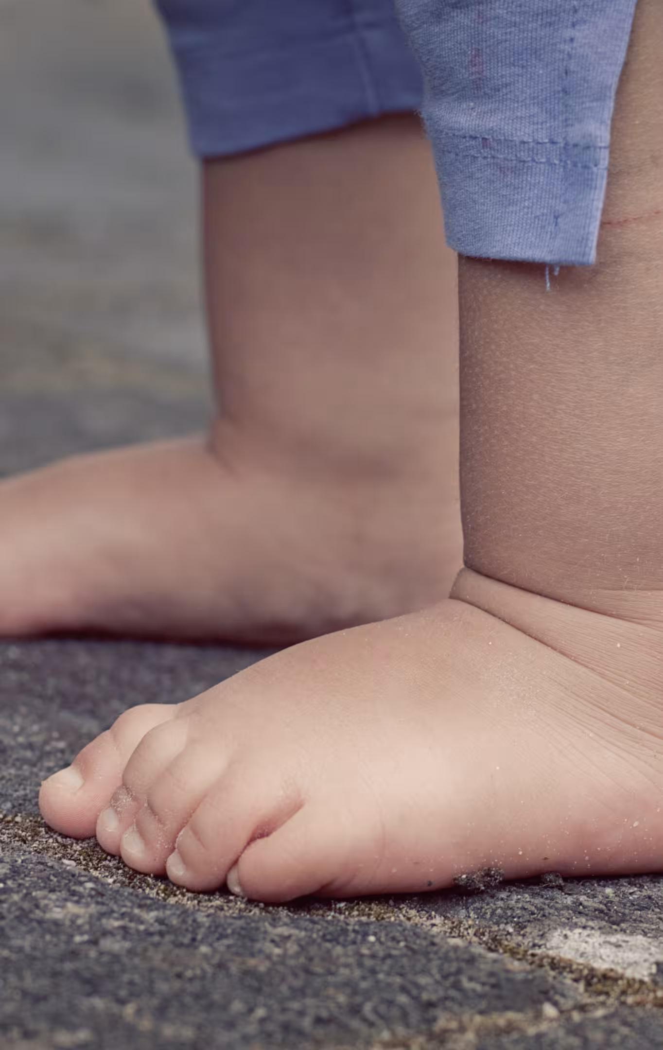 Nevhodná obuv u detí môže spôsobiť alebo zhoršiť ploché nohy