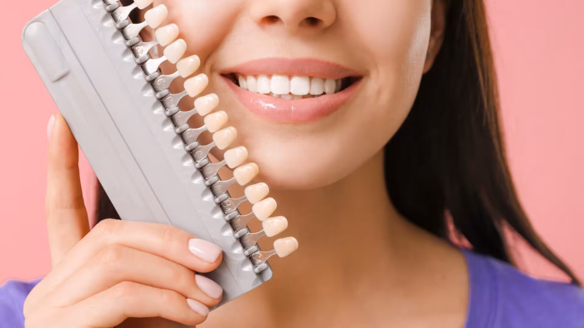 Profesionálne bielenie zubov - pomocou metódy BlancOne